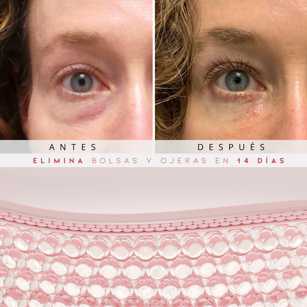 Reparador Bolsas y Ojeras con LED y Microcorriente