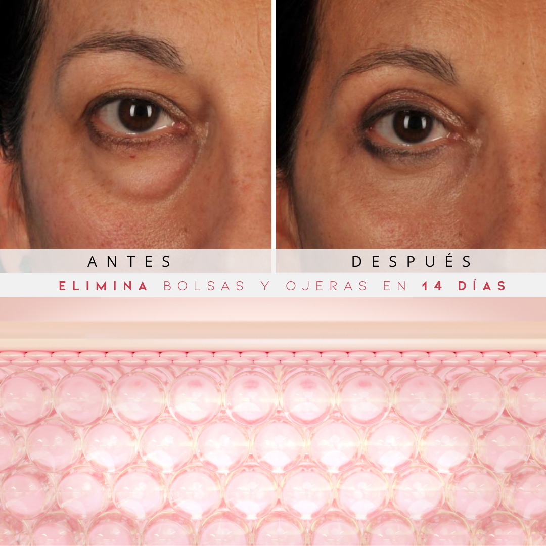 Reparador Bolsas y Ojeras con LED y Microcorriente